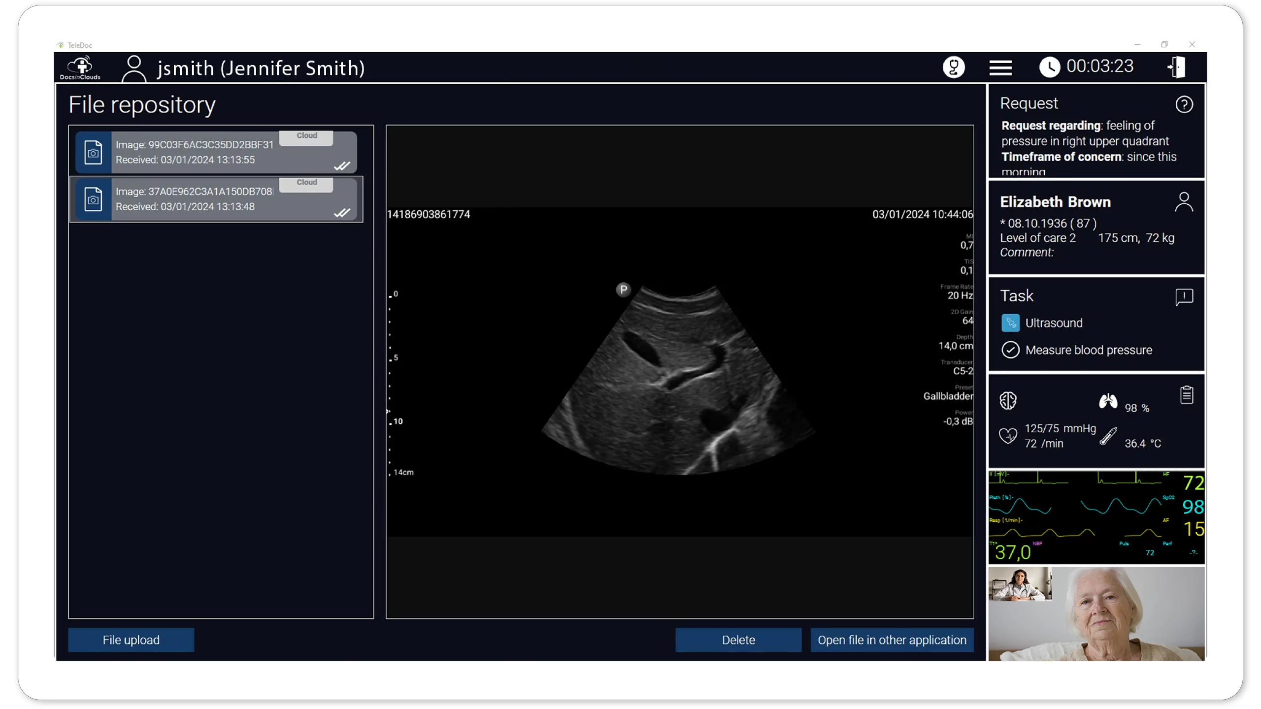 screenshot-teledoc-docsinclouds-ultrasound-en